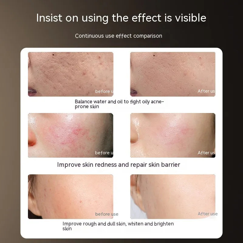 LED IPL Beauty Mask - SkinTok