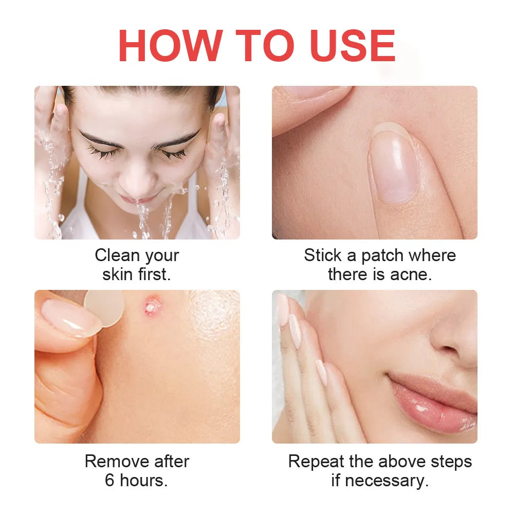Mighty Clear™ Invisible Acne Patches - SkinTok